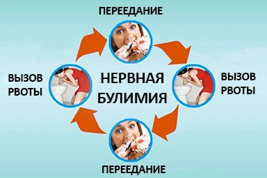 Лечение булимии в Яблоновском